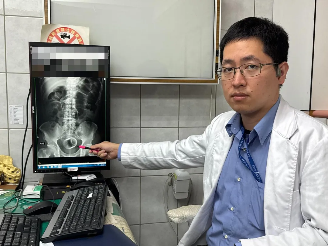 李綜合醫院外科醫師吳坤達，手術把塞在肛門的杯子取出。（圖／李綜合醫院）