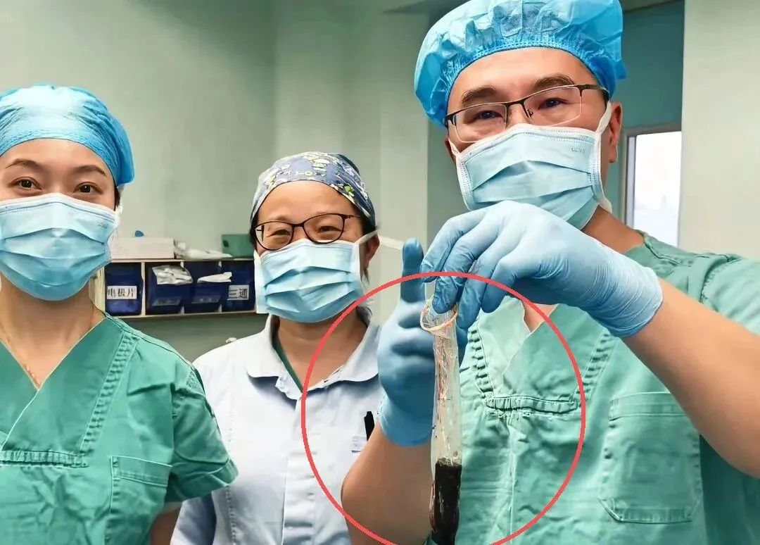 醫生利用保險套將打火機包裹後從胃中取出。（圖／翻攝上觀）