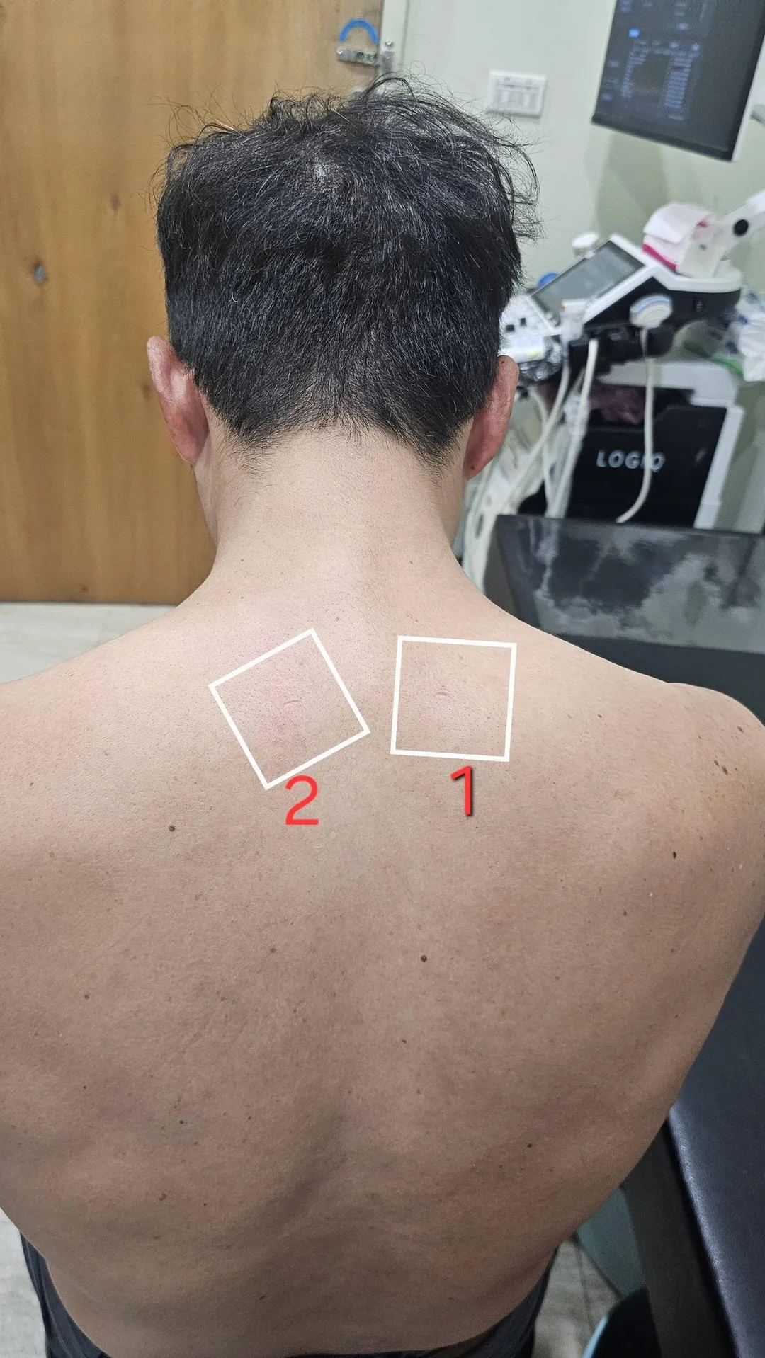 對於難治的纖維化硬塊,建議尋求專業復健科醫師,透過增生療法、震波等方式,侯鐘堡醫師也親身試驗。(圖/翻攝侯鐘堡醫師臉書)
