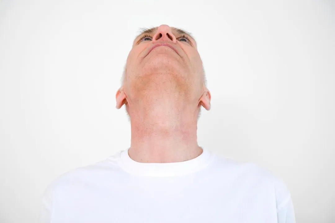 下咽癌是原生於下咽的惡性腫瘤,好發於55至70歲男性。(示意圖/123RF)