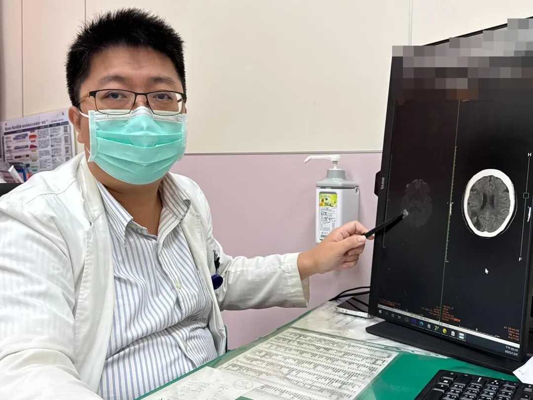 李綜合醫院神經內科醫師張峻誠說,一名婦人右側中大腦動脈阻塞而影響到視野。(圖/李綜合醫院)
