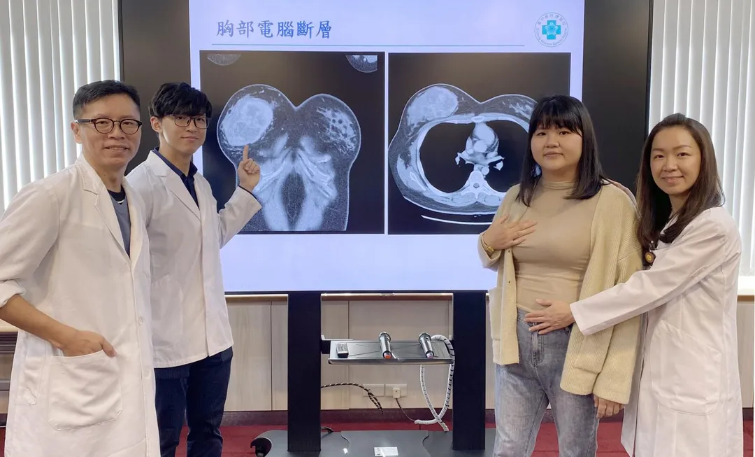 臺中榮總整形外科、乳房外科、婦女醫學部團隊共同照護陳小姐(右2),在孕期切除右乳房葉狀瘤、重建並順利生子。(圖/臺中榮總)