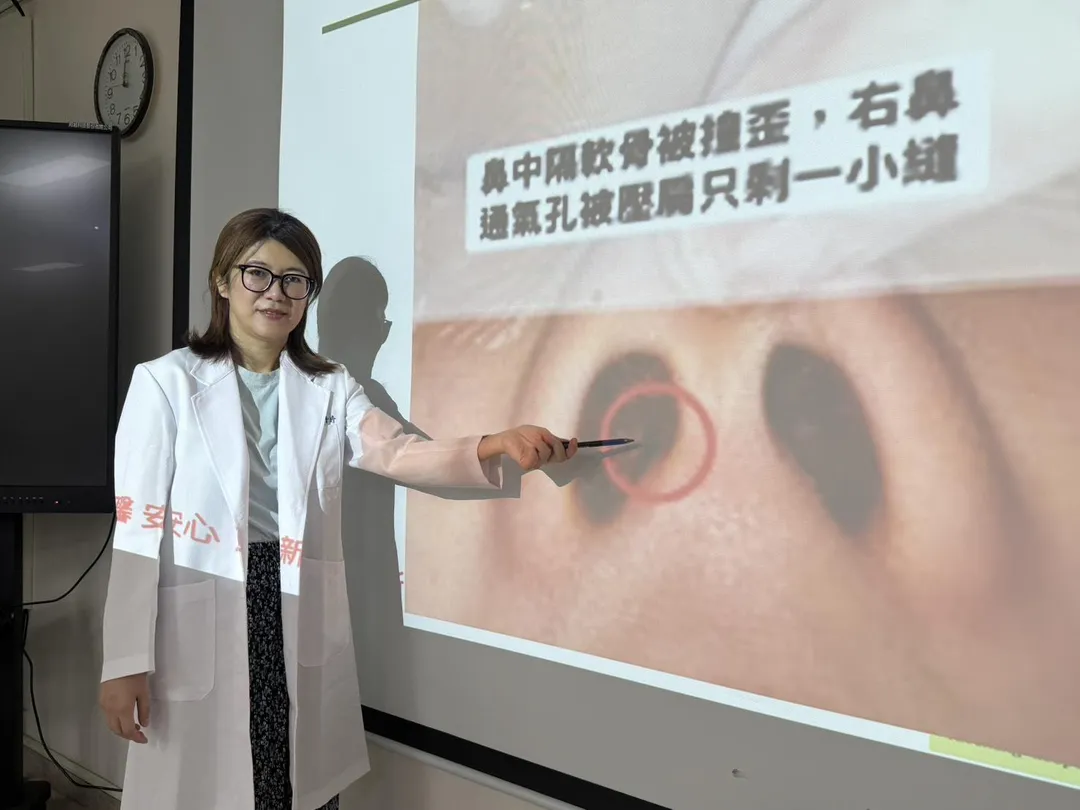 臺中醫院耳鼻喉科林于婷醫師說明，患者車禍後因鼻子被撞歪，導致右側呼吸道只剩下一個小洞口（筆指處）。（圖／臺中醫院）