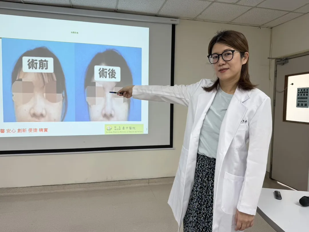 林于婷醫師利用患者自體肋軟骨重建被車禍撞歪的鼻子，術後鼻子堅挺漂亮（筆指處），原本呼吸道也恢復通暢。（圖／臺中醫院）