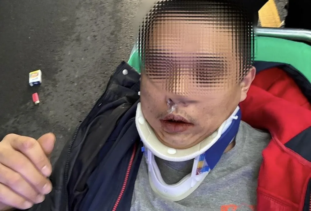 男子毒駕自摔口鼻還殘留毒品粉末。(圖/翻攝畫面)