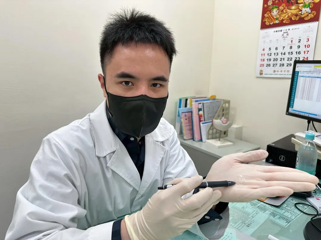 個案安裝保羅青光眼導管,眼壓降低且不需要點青光眼的藥水。(圖/童綜合醫院)