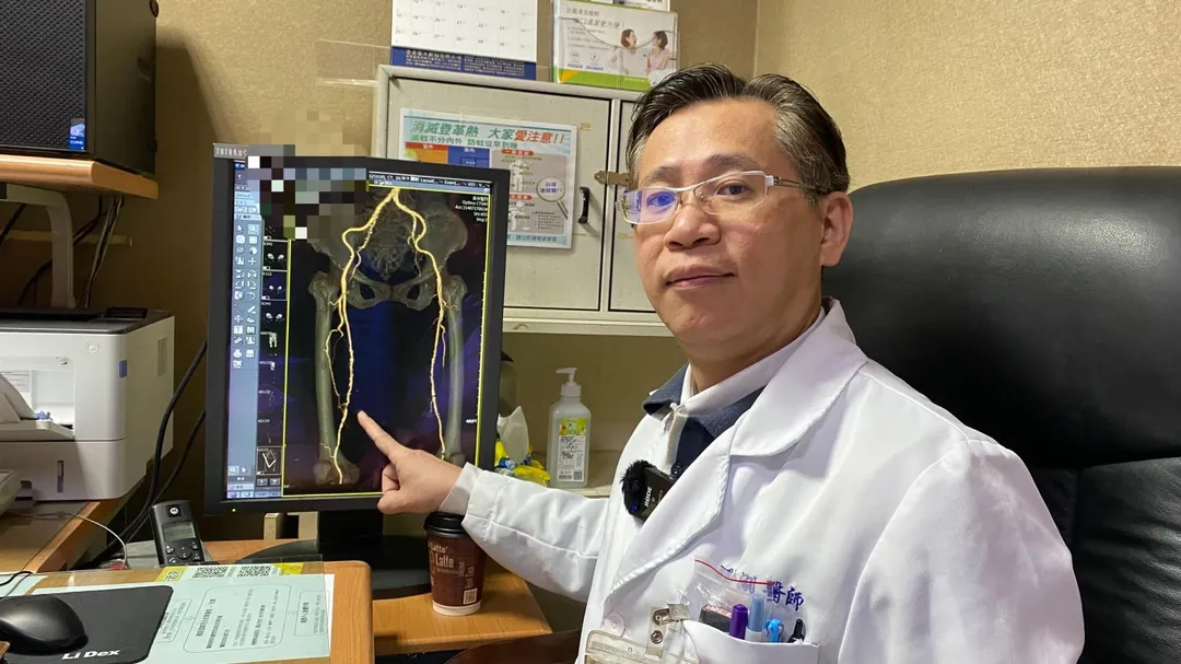 賴金湖醫師解釋，患者因動靜脈「雙重循環不良」，傷口無法癒合，先後採用兩種手術方式為患者治療。（圖／員榮醫院）
