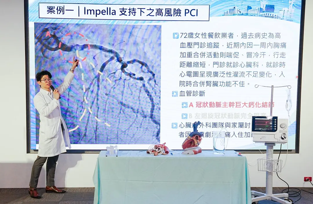 台中一名72歲餐飲業者，近期在短短一週內頻繁出現劇烈胸痛、冒冷汗及活動即喘等症狀，緊急就醫後發現，其心臟冠狀動脈主幹存在巨大鈣化結節。（圖／中醫大附醫）
