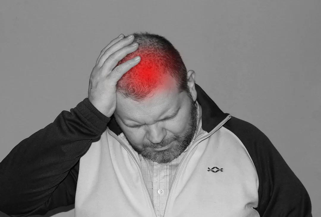 動脈瘤破裂的典型症狀為此生從未經歷過如此嚴重的爆炸性頭痛,有時也會伴隨頸部僵硬疼痛。(示意圖/Pixabay)