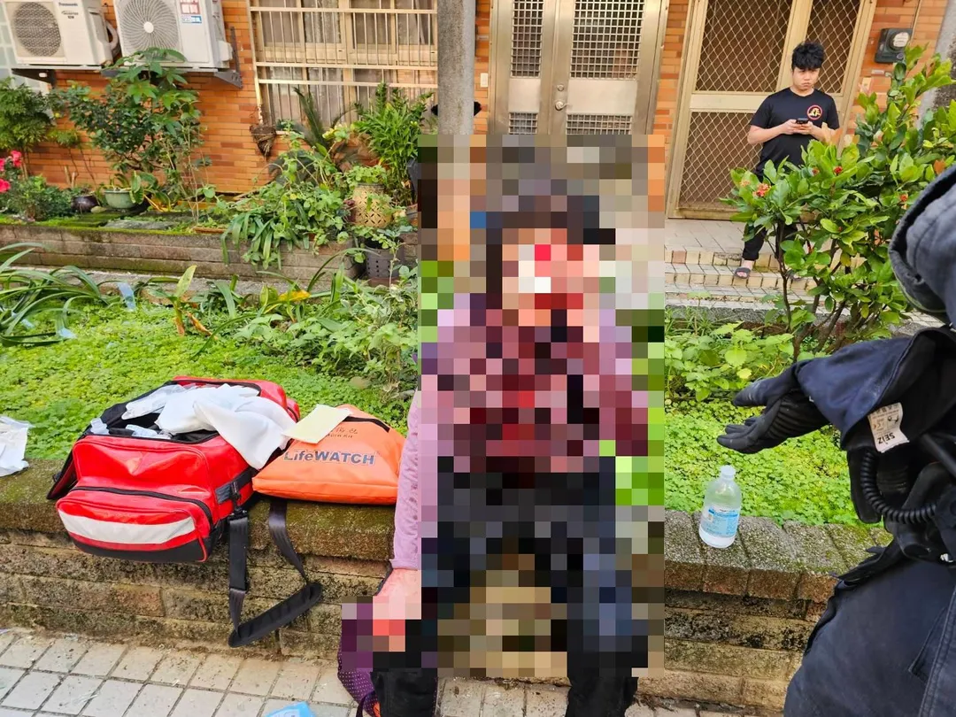 70歲洪女臉部有撕裂傷。（圖／民眾提供）