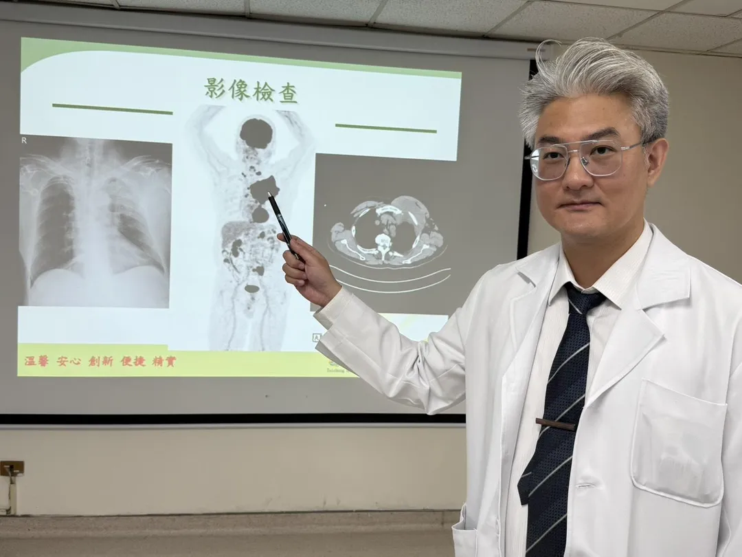 江佳駿醫師說明，患者左側胸部遭癌細胞入侵，出現明顯的14公分腫瘤。（圖／臺中醫院）