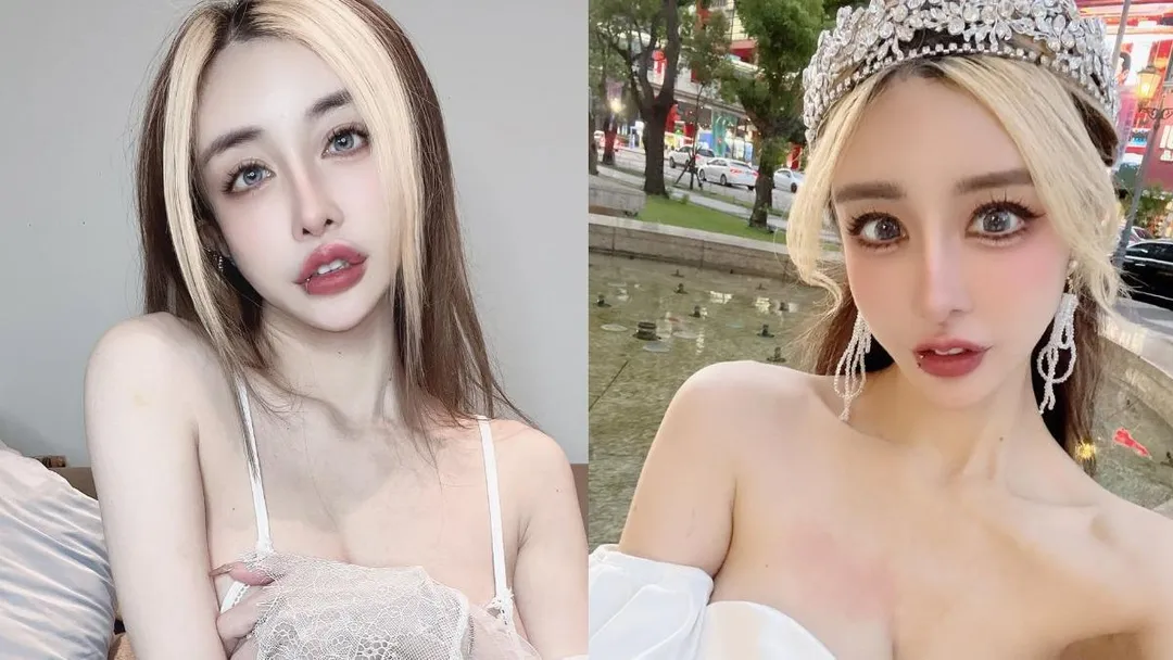 43歲的網紅雪碧從18歲開始接受整形手術,動刀部位涵蓋額頭、鼻子、眼睛、下巴等處。(圖/翻攝自雪碧IG)