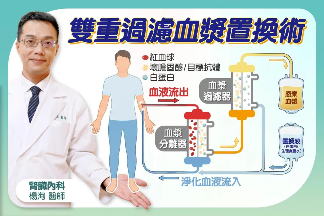 血漿置換術透過儀器分離病人血液，移除含有致病抗體的血漿，協助神經與肌肉訊號傳導恢復正常。（圖／台中慈濟醫院）
