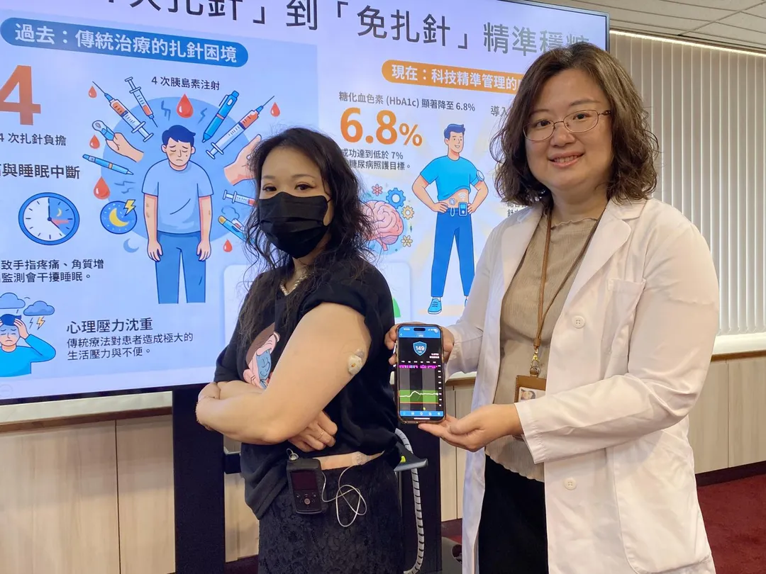 余小姐（左）為了穩定血糖，曾單日扎針達14次，在裝設胰島素幫浦結合連續血糖監測系統後，免扎針且更精準控制血糖。（圖／臺中榮總）