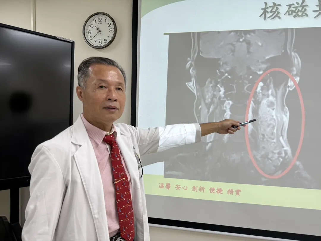 衛生福利部臺中醫院耳鼻喉科鄧政宗醫師說明患者左頸部微凸部位，就醫進一步檢查竟發現是12公分長巨大腫瘤。（圖／臺中醫院）