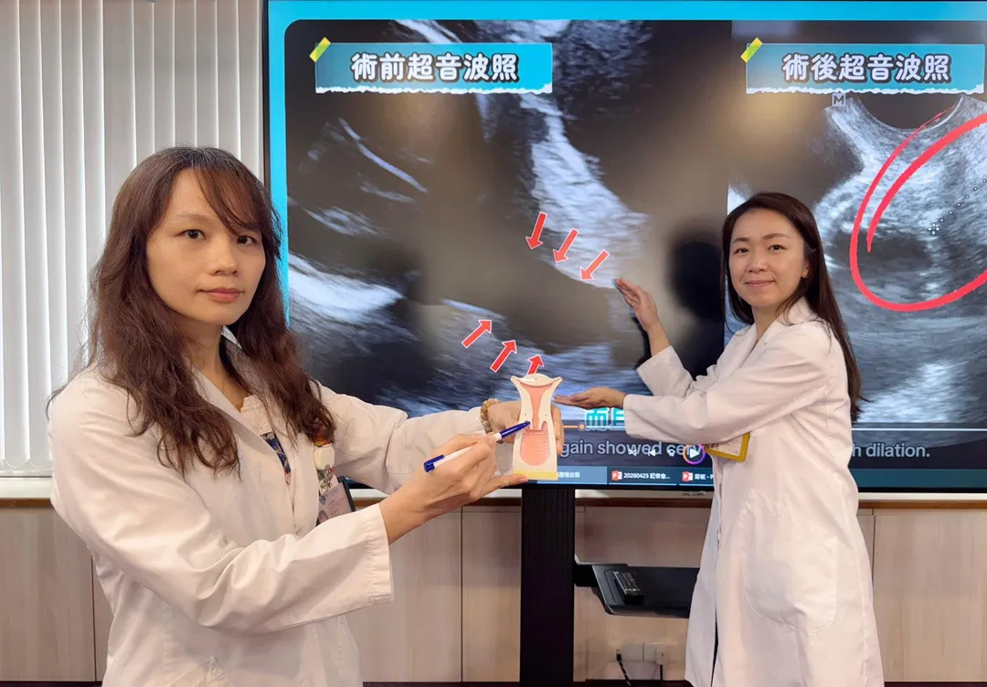 臺中榮總婦女醫學部高危險妊娠科主任陳雅芳(左)指出子宮頸縮短及擴張位置；醫師林俐伶(右)說明，丁小姐子宮頸擴張情形透過超音波檢查清楚可見。（圖／臺中榮總）