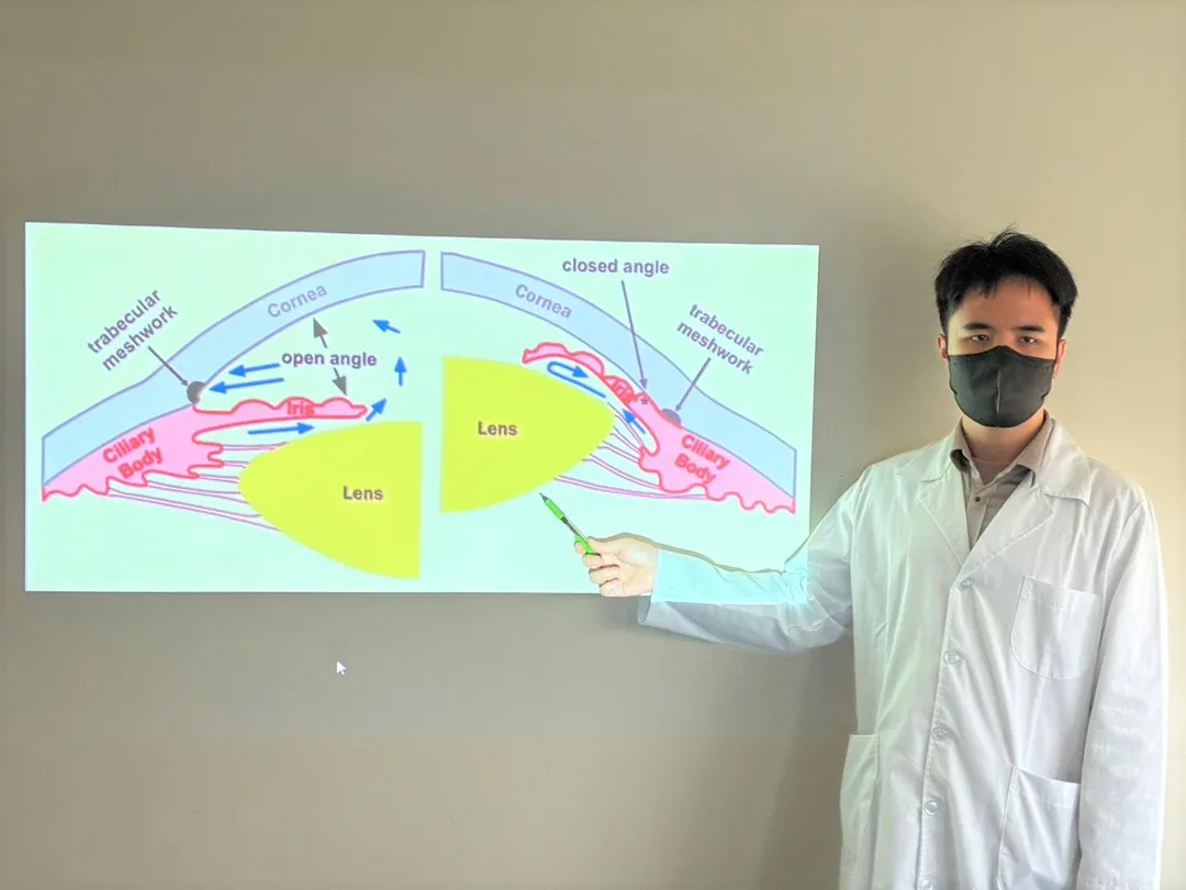 童綜合醫院眼科楊啓蘭醫師筆指圖右處即為急性青光眼發作眼部圖示，左圖為眼部正常情況。（圖／童綜合醫院）