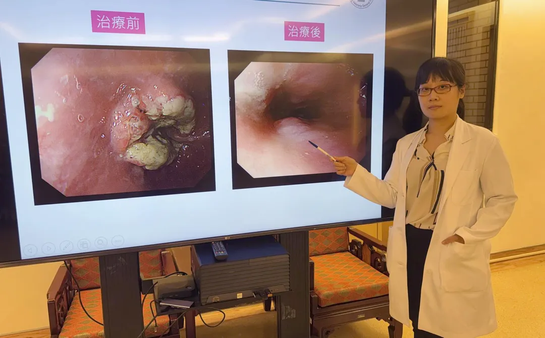 透過內視鏡檢查，王先生治療前後，腫瘤病灶明顯改善。（圖／臺中榮總）