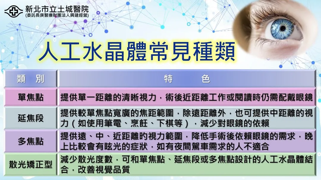 陳姵穎醫師說明人工水晶體可依患者工作需求、閱讀習慣與生活型態進行個別化選擇。（圖／新北市立土城醫院）