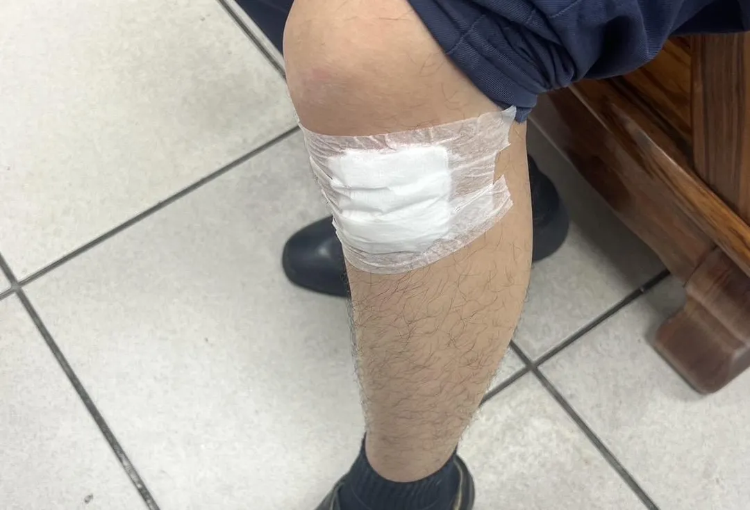 員警腿部受傷。（圖／翻攝畫面）