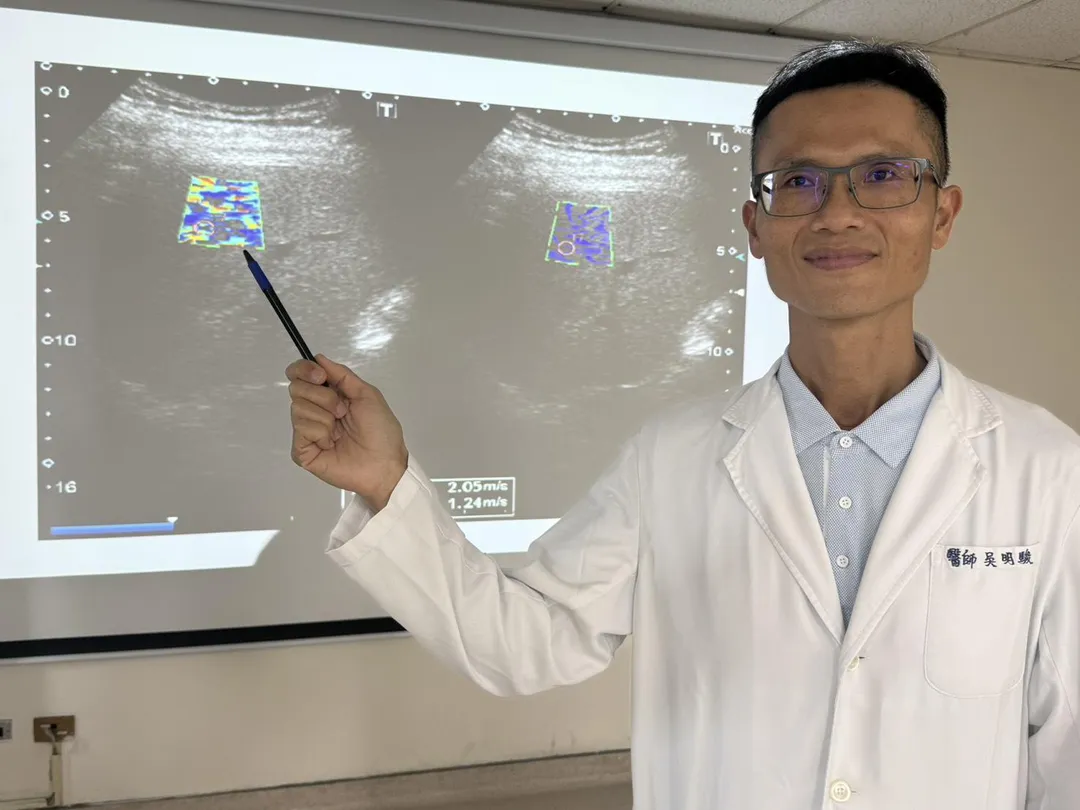 吳明駿醫師說明46歲壯男到院時進行肝臟纖維化掃描檢查，發現患者因重度脂肪肝造成肝臟纖維化，再不控制恐要面臨肝硬化、甚至肝癌的風險。（圖／臺中醫院）