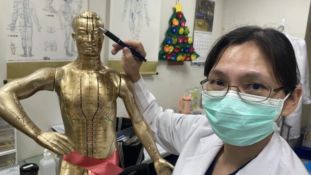 員榮醫院中醫師張淵雅解說柯姓患者治療的穴位。（圖／員榮醫院）