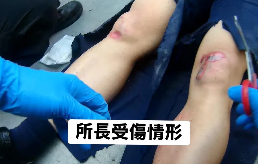 陳所長的傷勢。（圖／警方提供）