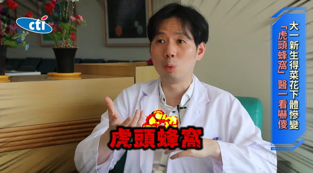 台北市立聯合醫院中興院區主任姜冠宇分享，曾有大一女學生因延誤就醫，私密處長滿如「虎頭蜂窩」般的病灶，令人震驚。（圖／翻攝《健康我+1》畫面）
