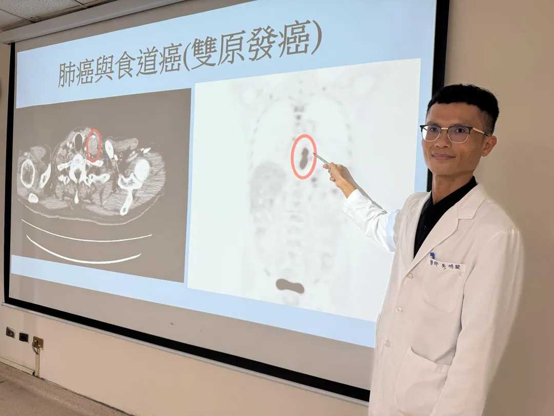 衛生福利部臺中醫院肝膽腸胃科吳明駿醫師指著患者發現食道癌的部位,說明與肺癌復發(左圖)、雙癌同時出現的情況。(圖/臺中醫院)