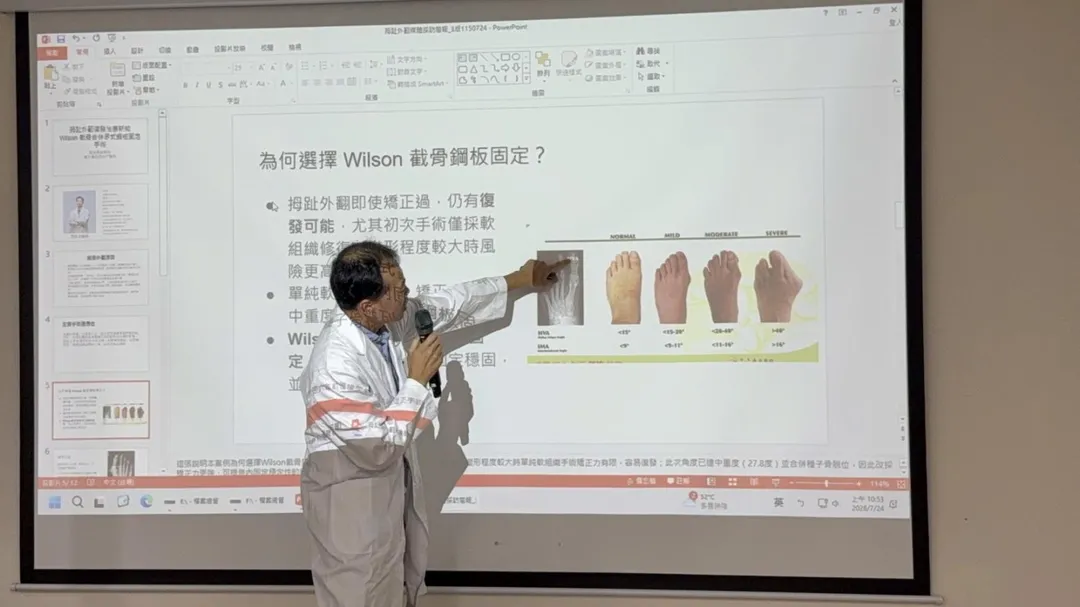 周育名醫師說明，拇指外翻依照角度可以分為輕度中度與重度，治療的方式也因人而異。（圖／臺中醫院）