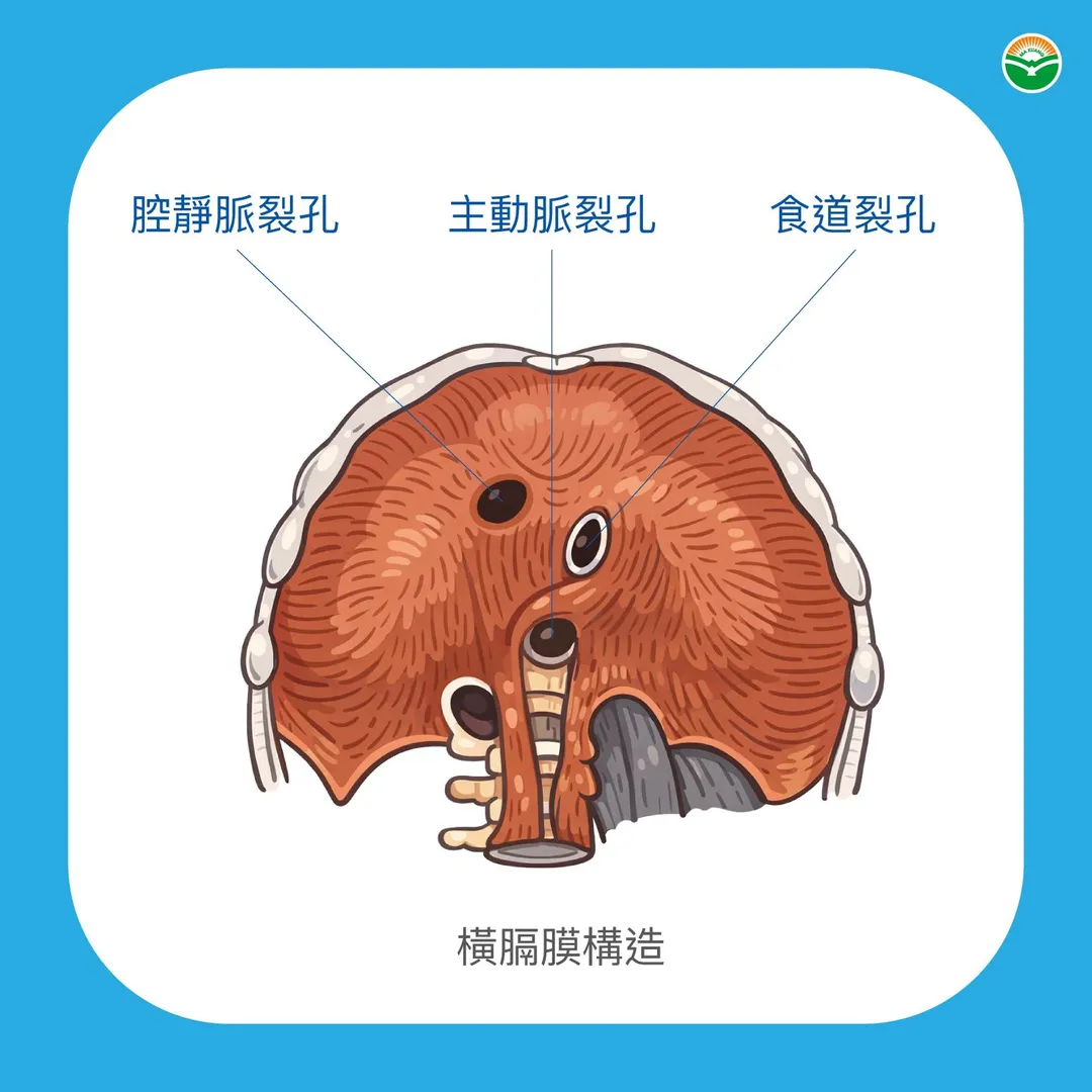 陳証豪醫師進一步說明,橫膈膜上有三個重要開孔,分別讓下腔大靜脈、食道與腹主動脈通過。(圖/馬光中醫)