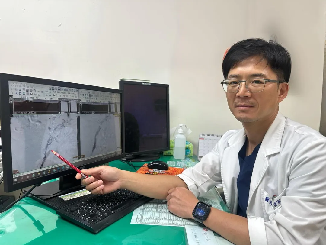 衛生福利部豐原醫院心臟外科胡家瑜醫師表示，深層靜脈血栓症狀可透過微創取栓術直接移除阻塞血栓，並降低肺栓塞及血栓後症候群等併發症風險。（圖／豐原醫院）
