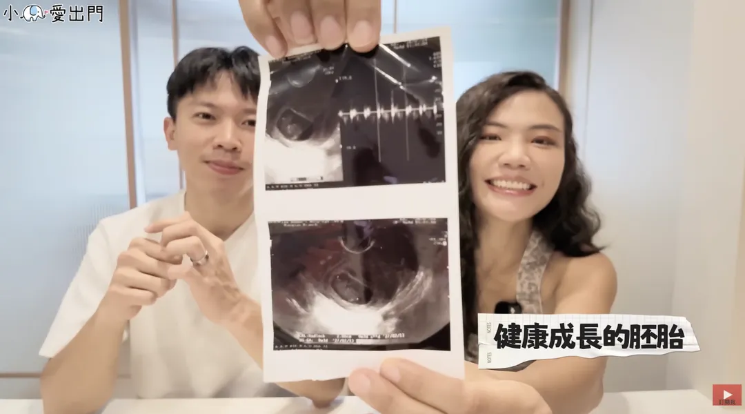 小象突然大出血，回診後醫師確認寶寶穩定成長中。（圖／翻攝自小象愛出門YouTube）