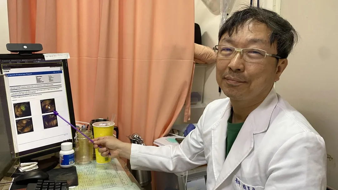員榮醫院胃腸肝膽科主任賴昱良醫師解說「膠囊內視鏡」的功能。(圖/員榮醫院)