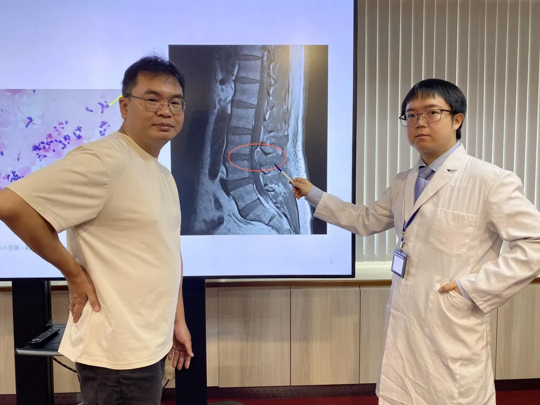 林先生(左)因發燒、腰痛不適至台中榮總就醫，感染科醫師黃顯博（右）安排檢查確診為金黃色葡萄球菌感染腰椎致硬脊膜外膿瘍合併脊椎骨髓炎。（圖／臺中榮總）