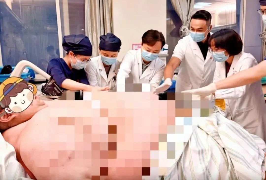 30歲陸男重達317公斤心肺衰竭瀕死 ，跨省ICU搶救13天。（圖／翻攝微博）