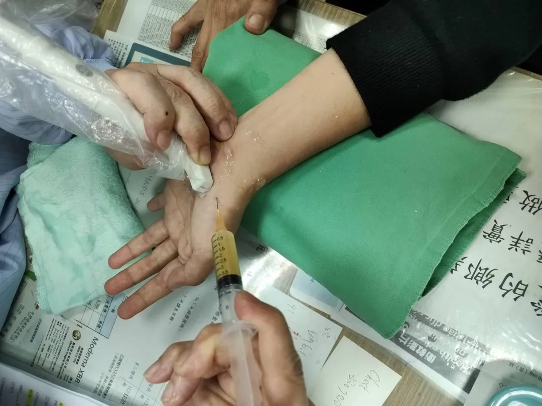 員榮神經內科主任葉宗勳醫師,使用超音波導引為患者施打PRP,解決患者術後麻痺的問題。(圖/員榮醫院)