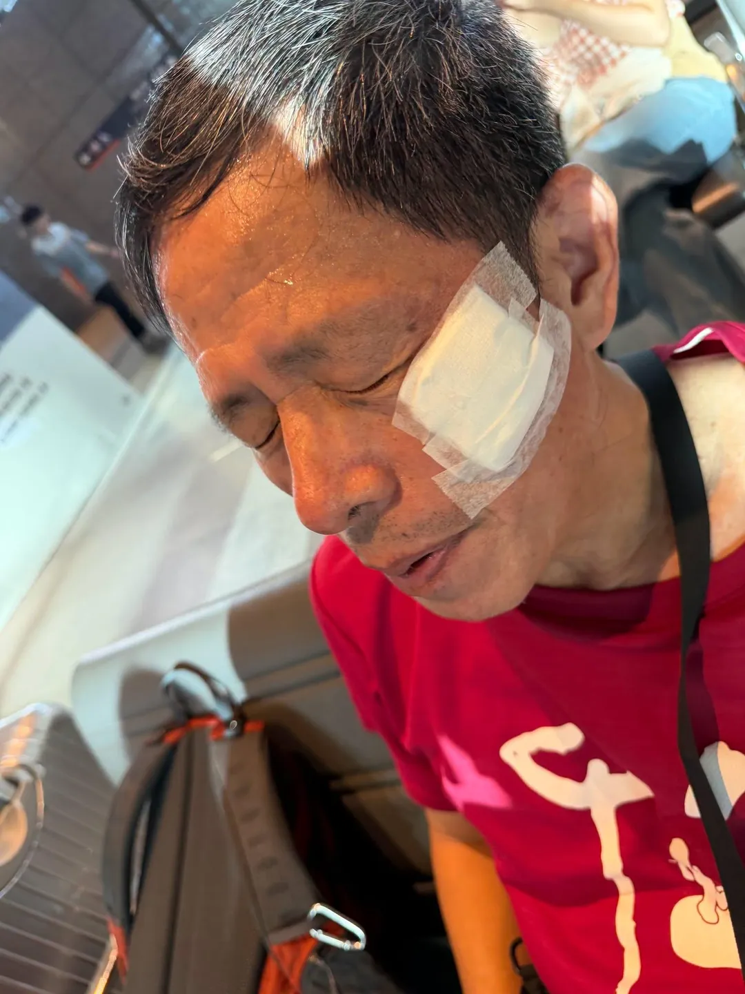劉克襄於高鐵台中站手扶梯上跌倒受傷。（圖／翻攝自劉克襄臉書）