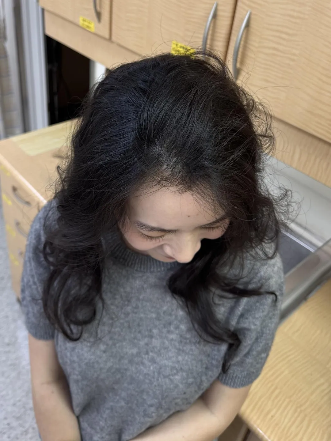 關艾琛醫師在兼具手術視野與安全的前提下，沿著髮際線精準下刀，讓手術痕跡自然隱於髮絲間，完整保留原有的長髮。（圖／北醫附醫提供）