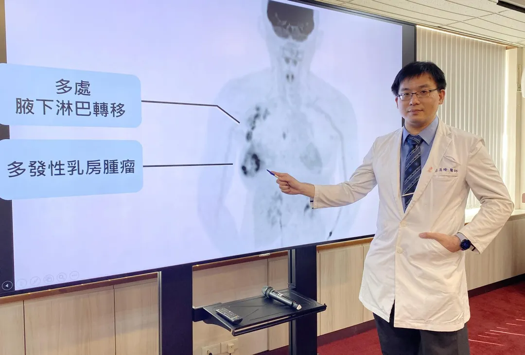 臺中榮總乳房腫瘤外科醫師蔡易臻指出,像王小姐在哺育時發現的妊娠相關乳癌,發生率每3000次懷孕就可能發生1例。(圖/臺中榮總)