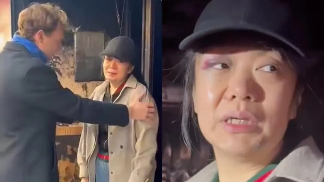 華裔第二代女店主阿琳右眼瘀傷，煙草餐館被洗劫。（圖／翻攝X「antoinejumel81」）
