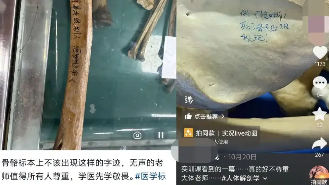 有疑似醫學生的網友日前在實訓課上拍下骨骼標本上的輕佻留言。(圖/翻攝大象新聞)