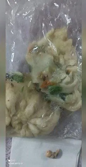 台東一名網友代友人發文，稱購買的水煎包裡有牙齒。（圖／翻攝自臉書社團）