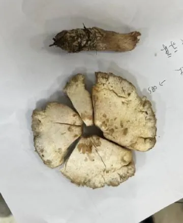 綠褶菇。（圖／台北榮總官網）