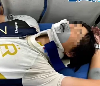 曾有選手在高速滑行時撞上外圍鐵欄杆，導致嘴唇割裂、撞斷3顆牙齒。（圖／翻攝畫面）