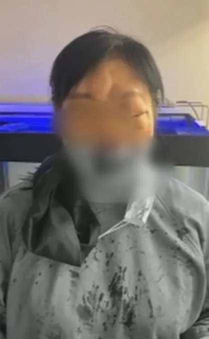 沈醫師被打到眼窩骨折、外傷性虹膜炎、臉面擦挫傷。（圖／中天新聞）