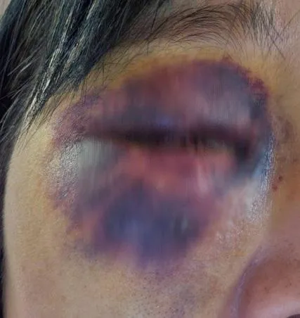 沈姓女醫師遭地球村美語負責人陳中義教唆幫派毆打致重傷。（圖／CTWANT／沈醫師提供）