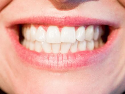 男子跨國網購便宜「遠端矯正隱形牙套」　竟造成永久性損傷
