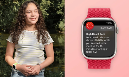 不要不理Apple Watch嗶嗶聲！12歲女童因「Apple Watch心率偵測」功能發現罹癌