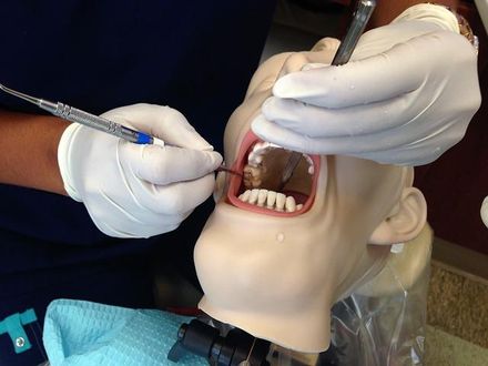 驚！女牙醫師自己拔智齒…網友驚呼「好大的勇氣」